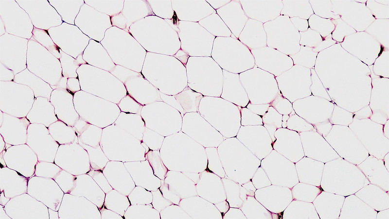 Univakouläre Adipozyten im weißen Fettgewebe