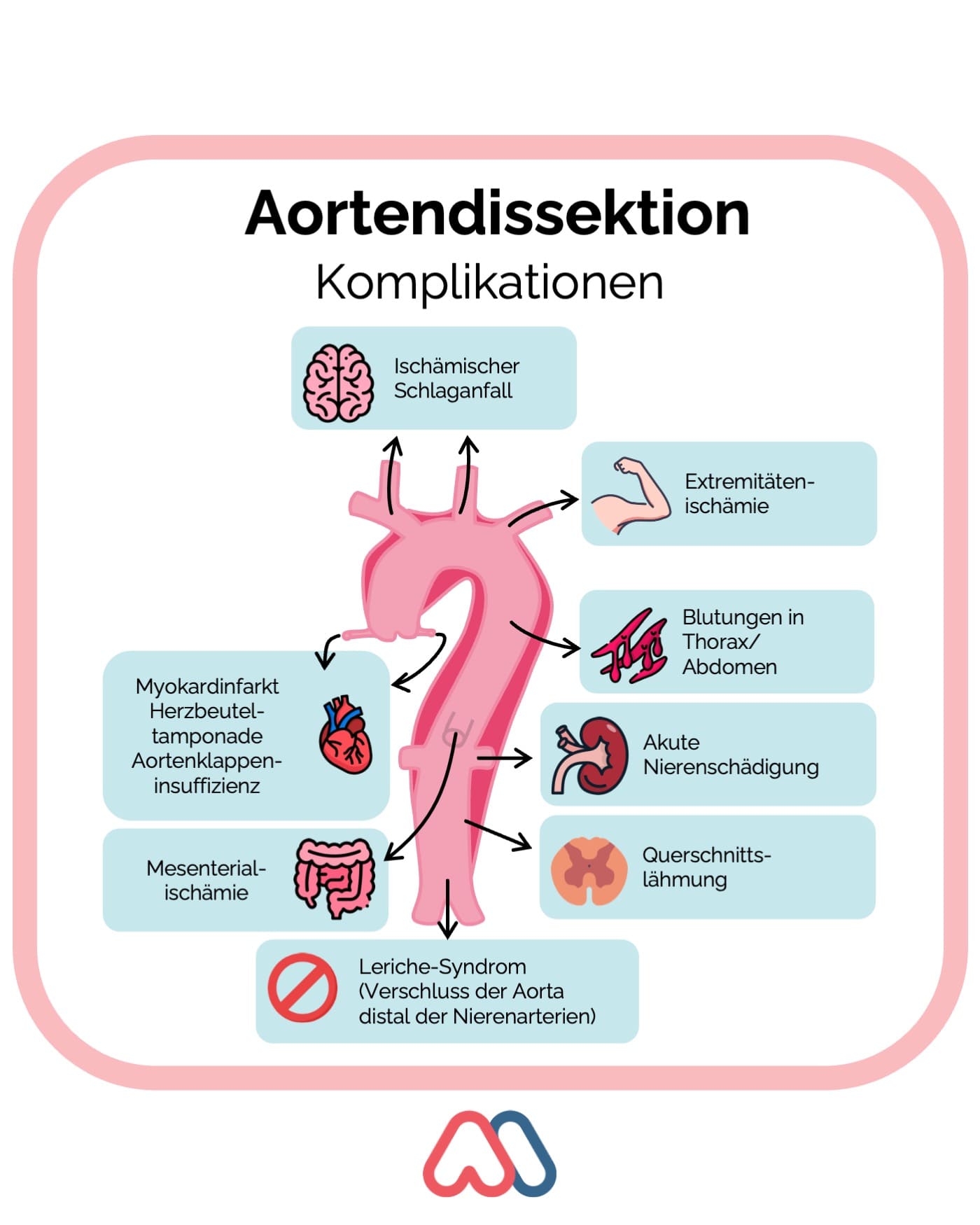 Aortendissektion Komplikationen