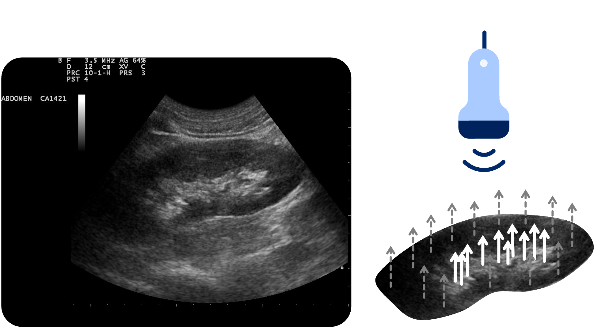Darstellung einer Niere im B-Mode