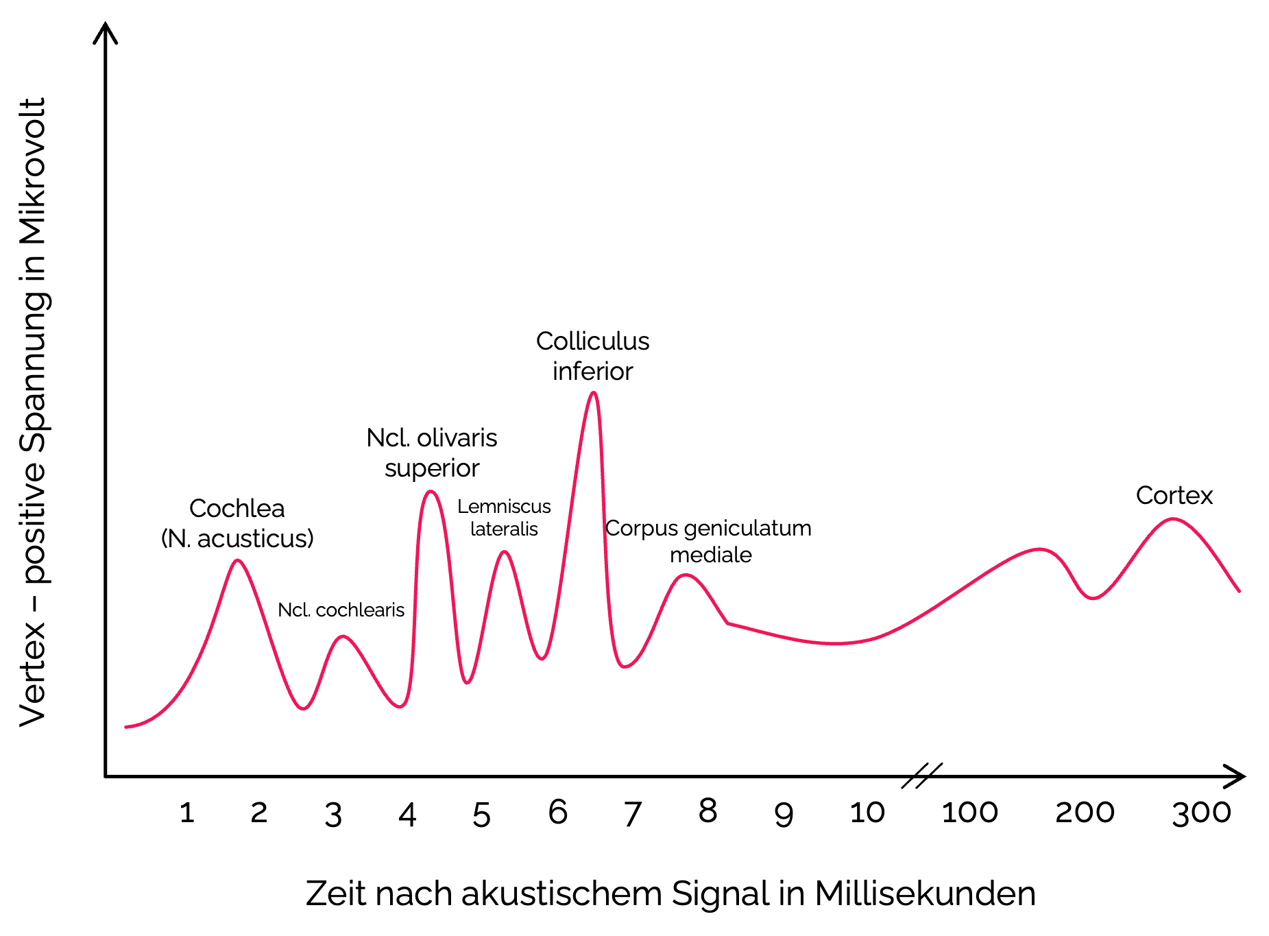 BERA (Brainstem Evoked Response Audiometry)