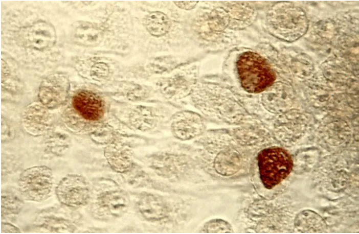 Chlamydia trachomatis Retikularkörperchen