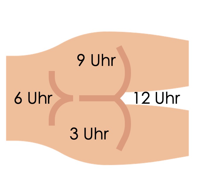 Lokalisation eines DRU-Befundes in Linksseitenlage