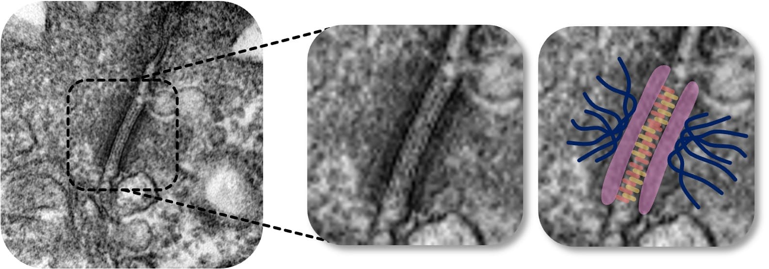 Desmosom in der Elektronenmikroskopie (TEM)