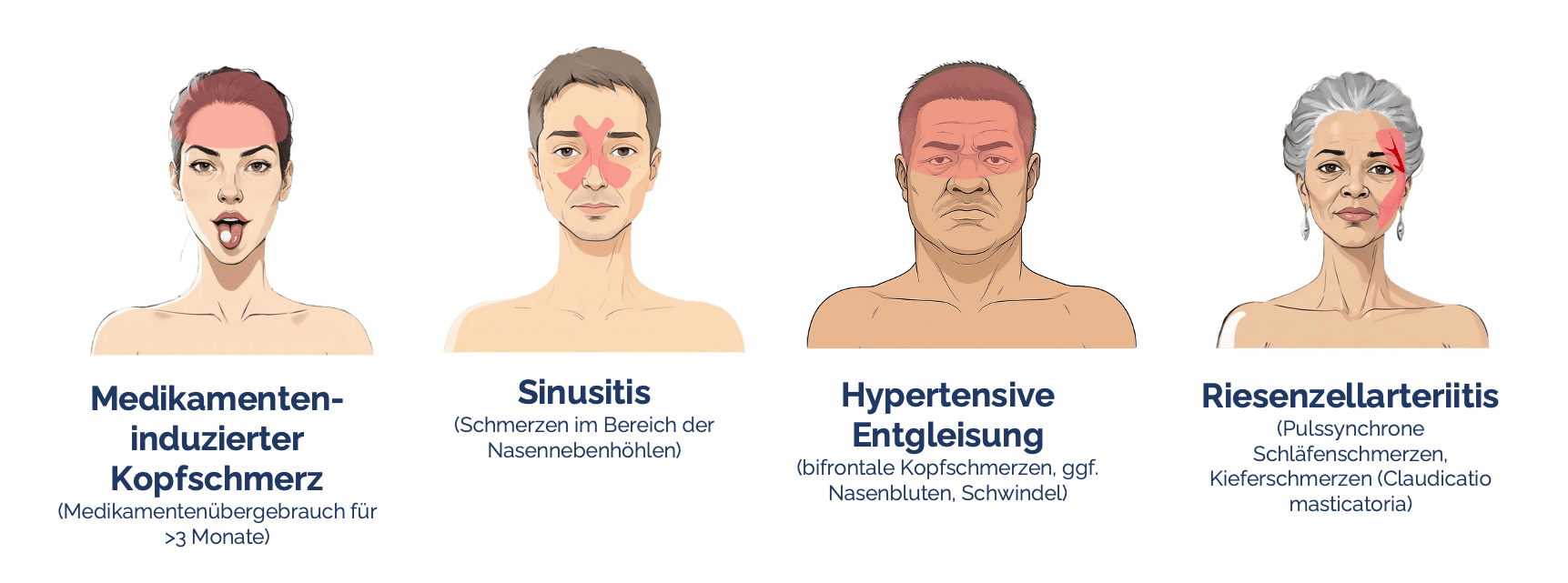 Sekundäre Kopfschmerzen