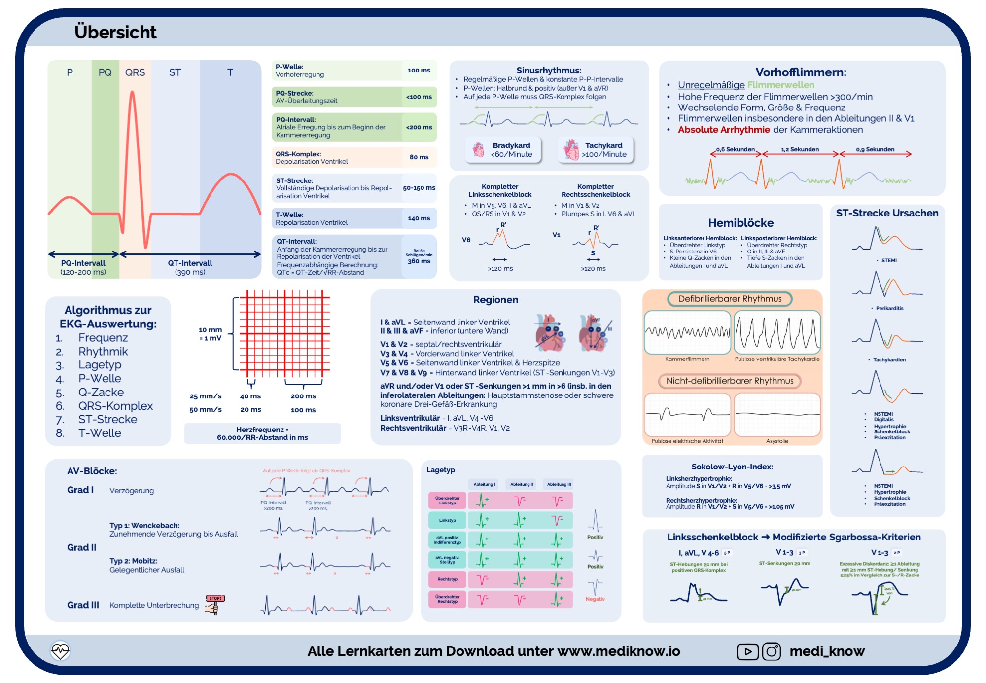 EKG-Lernkarten (Beispielseite)