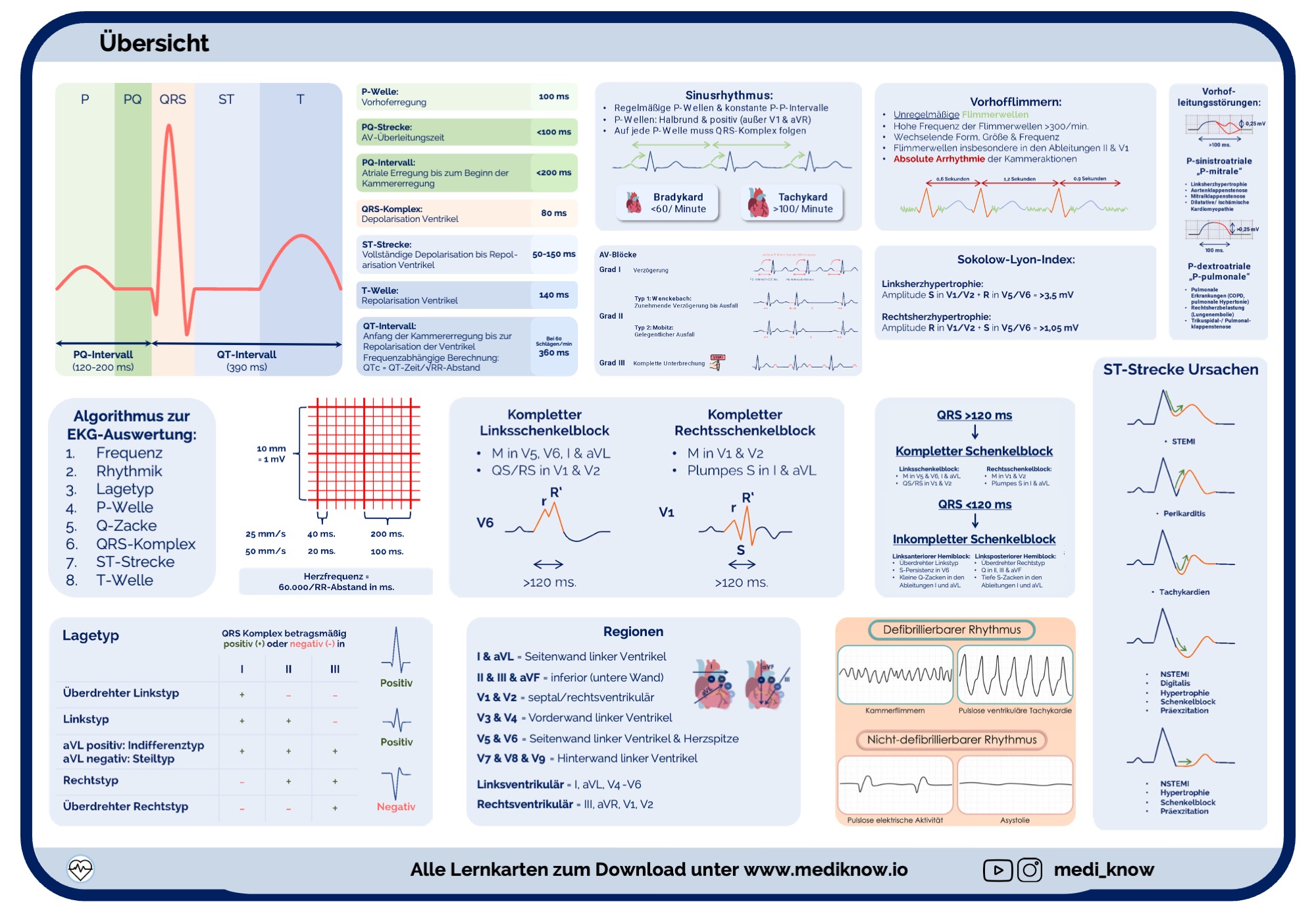 EKG-Lernkarten (Beispielseite)
