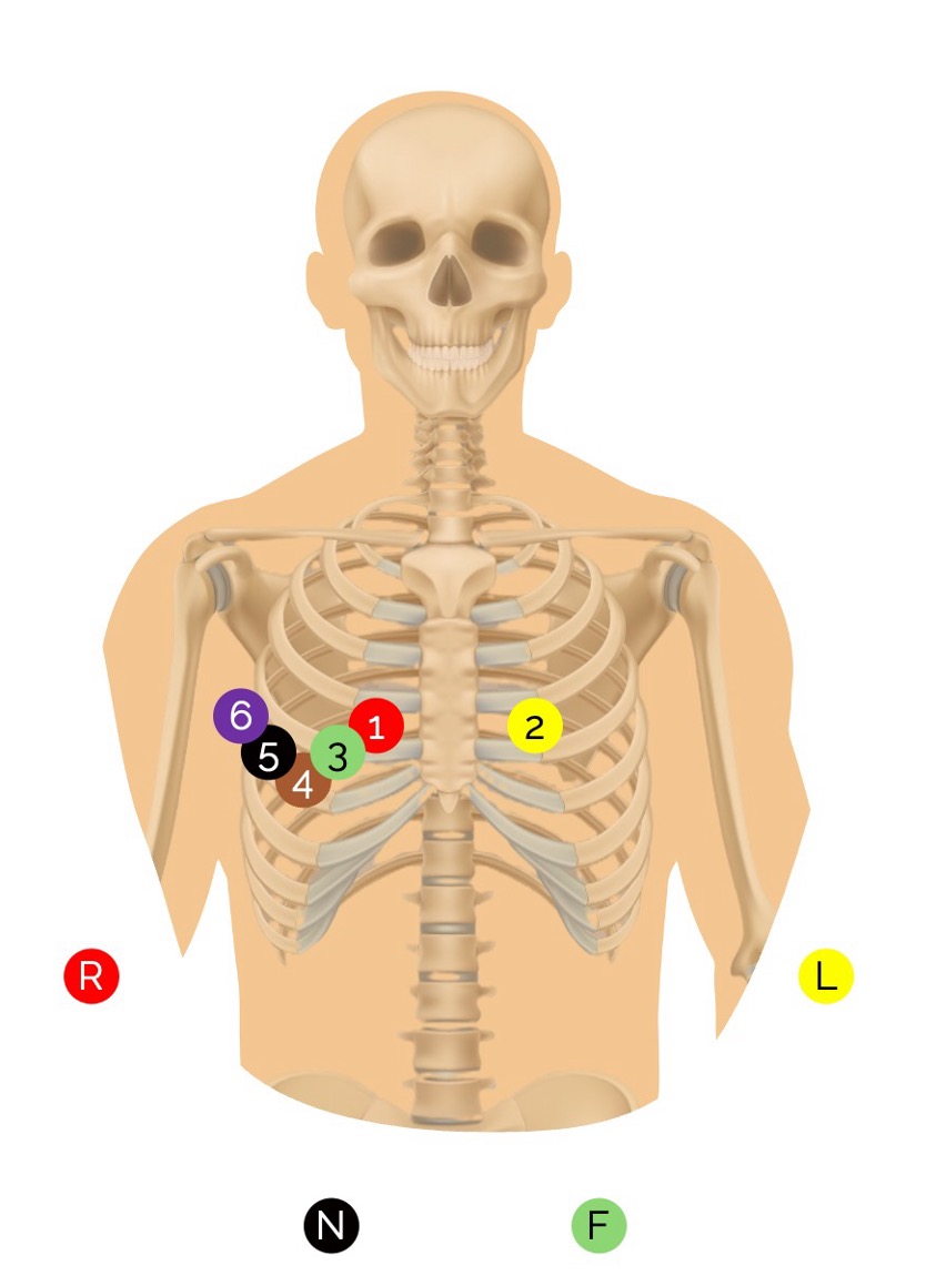 EKG-Ableitungen V3r-V6r