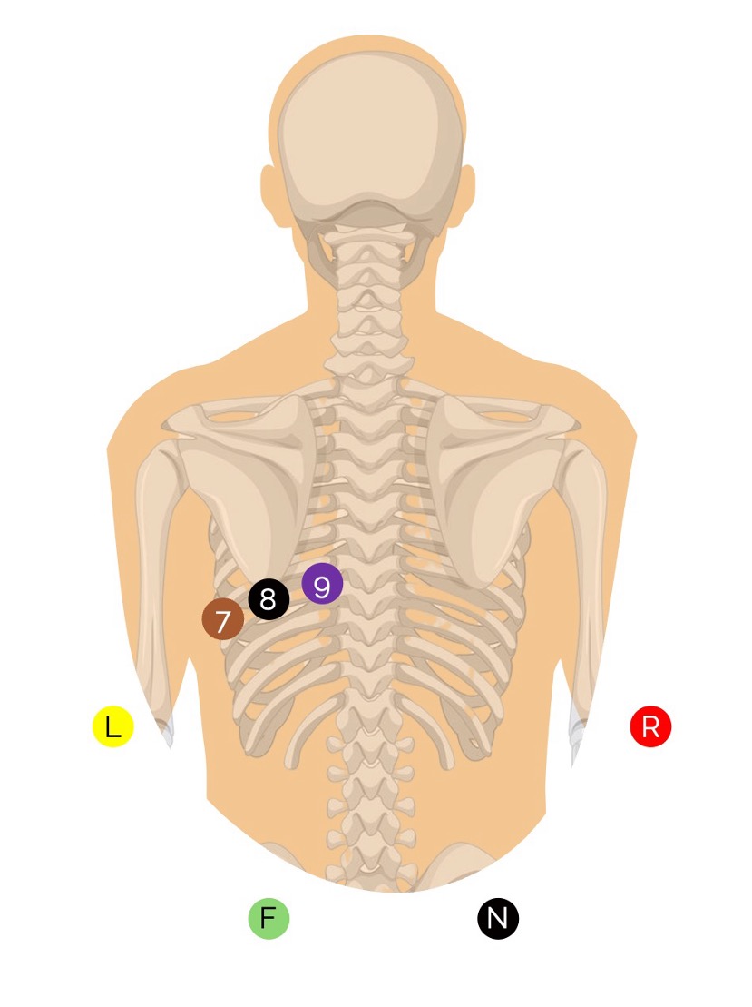 EKG-Ableitungen V7-V9