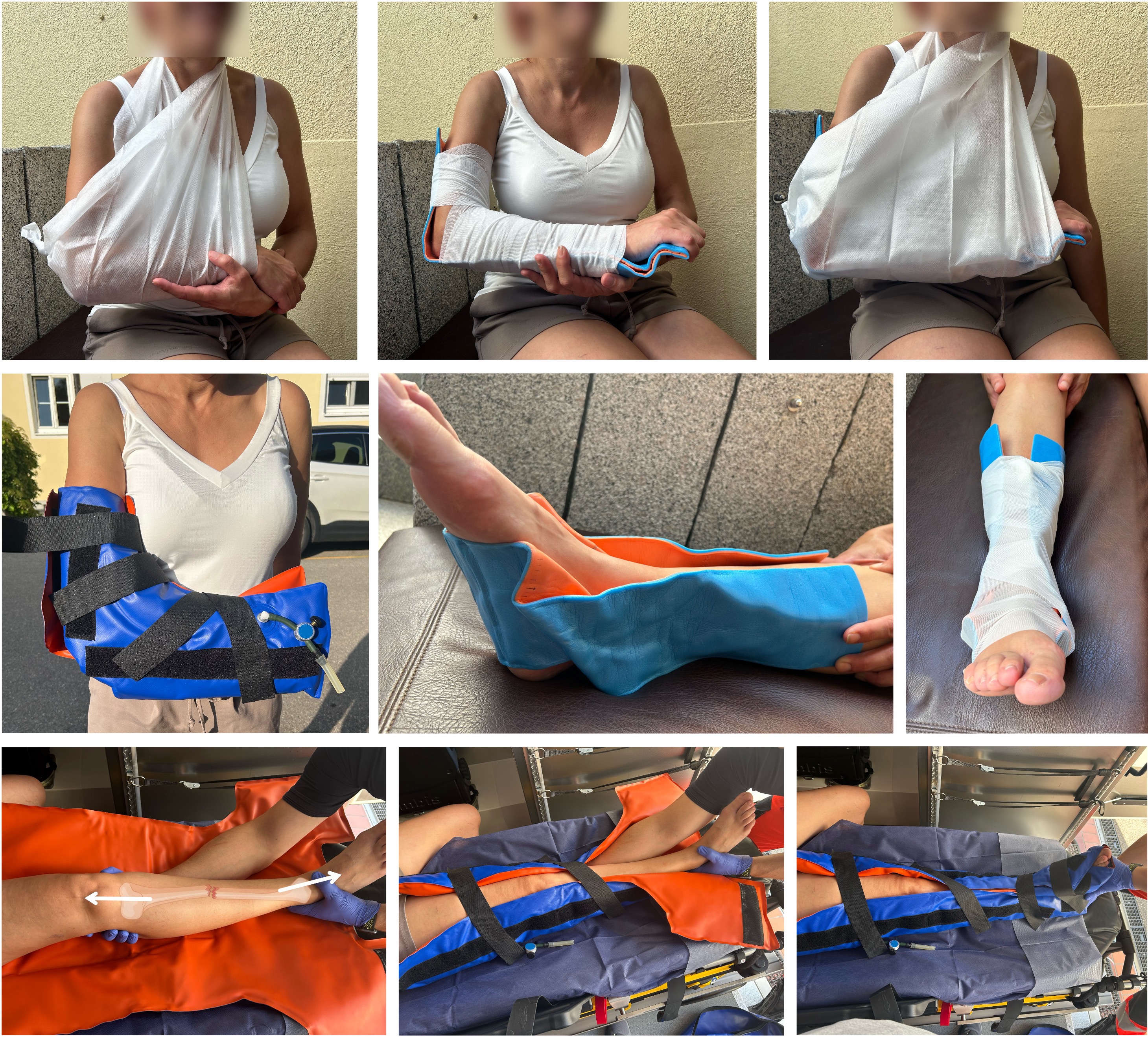 Extremitätenimmobilisation