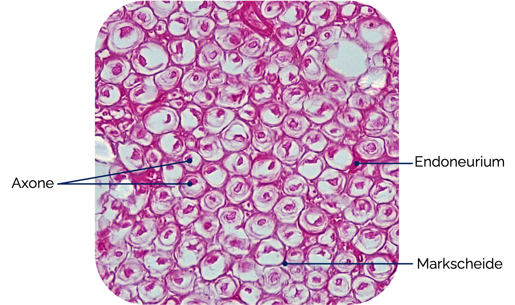Peripherer Nerv im Querschnitt