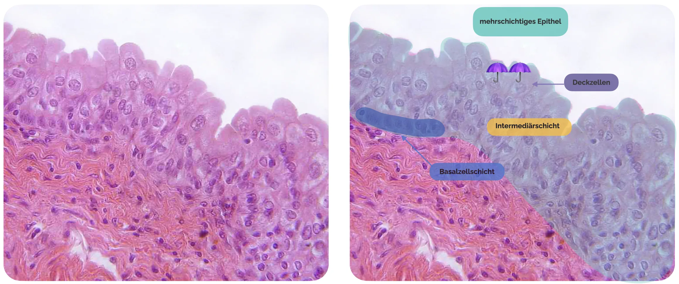 Histologisches Präparat der Harnblase (Urothelschichten)