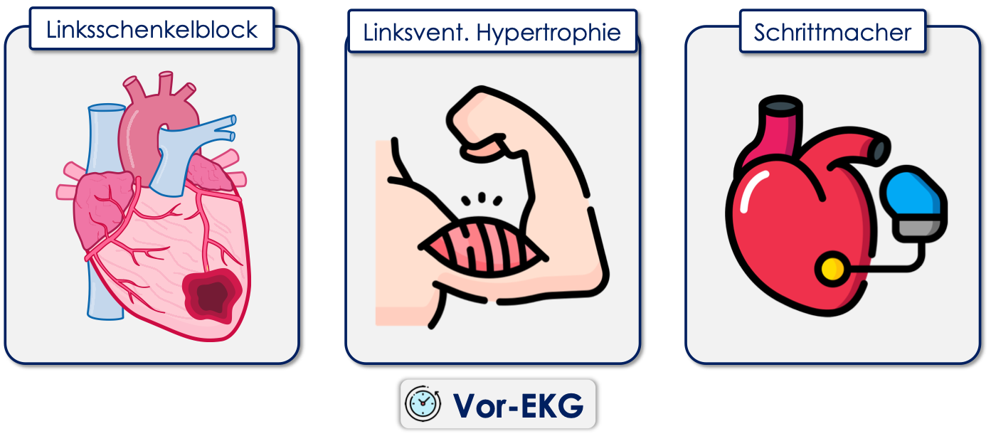 Vergleich mit Vor-EKGs