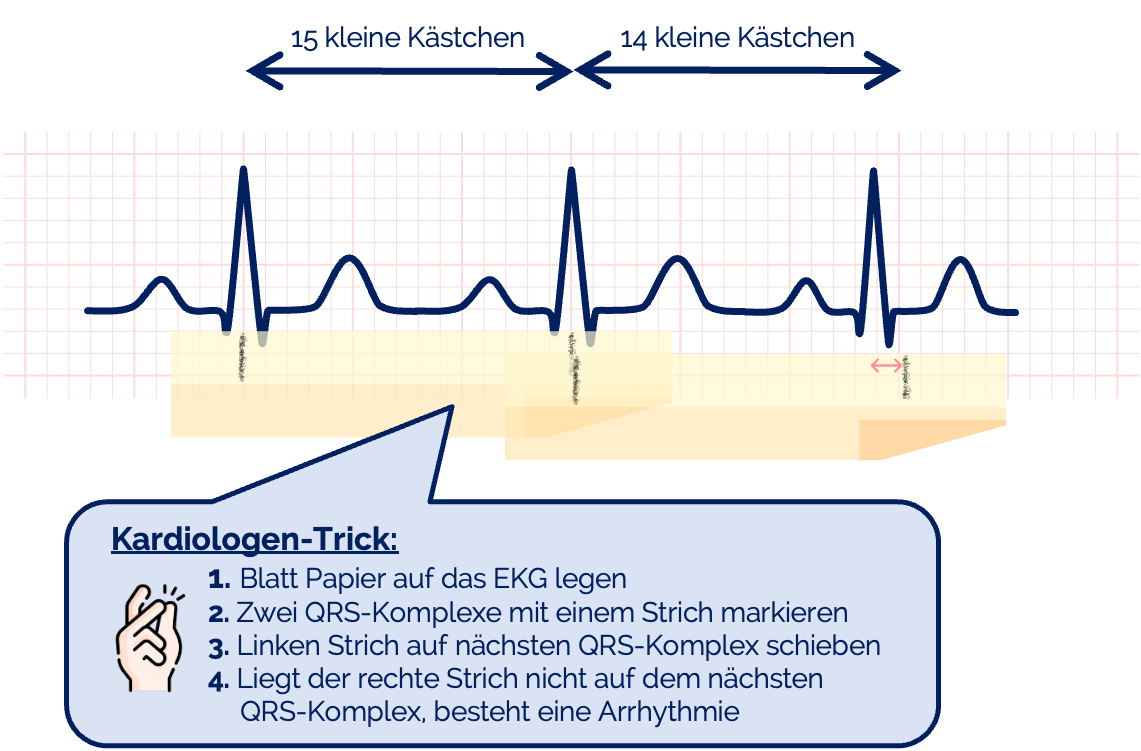 Kardiologen-Trick - Rhythmusanalyse im EKG