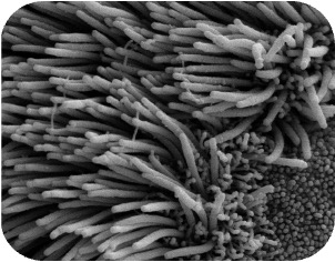 Kinozilien des respiratorischen Flimmerepithels (REM, zusätzlich Mikrovilli rechts unten im Bild)
