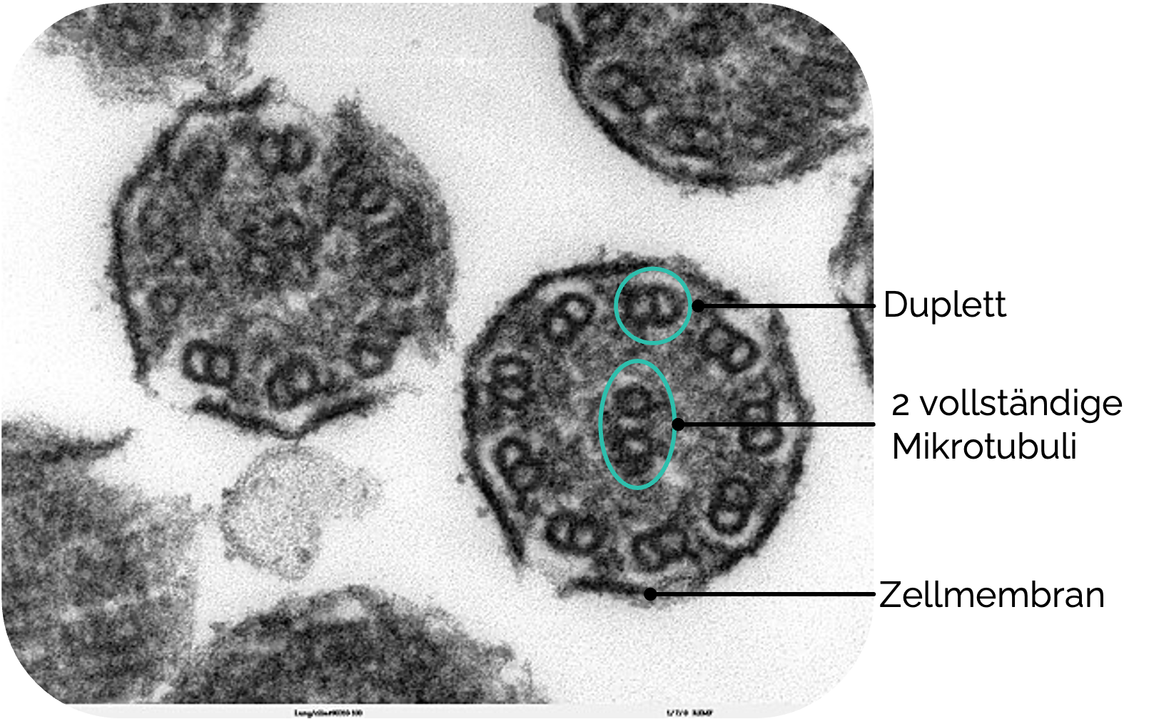Kinozilien unter dem Elektronenmikroskop (TEM) im Querschnitt