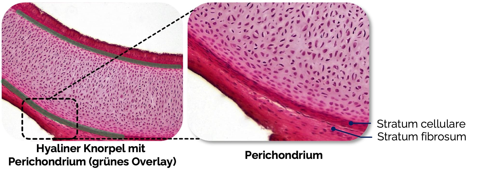 Hyaliner Knorpel mit Perichondrium