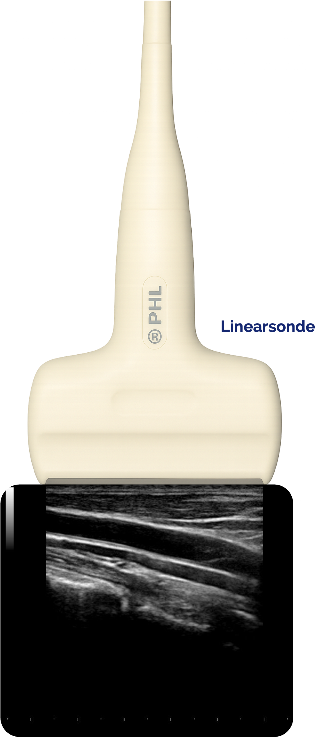 Linearsonde - Darstellung der A. carotis interna