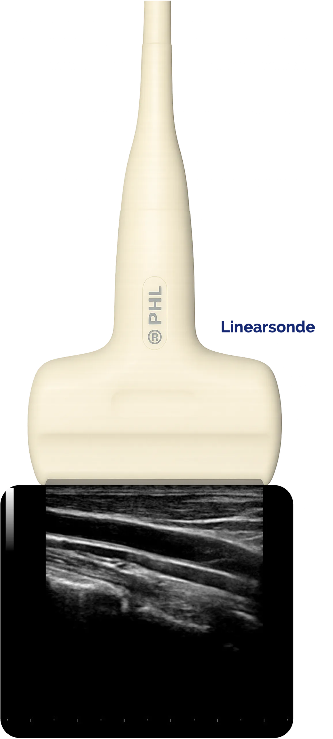 Linearsonde - Darstellung der A. carotis interna
