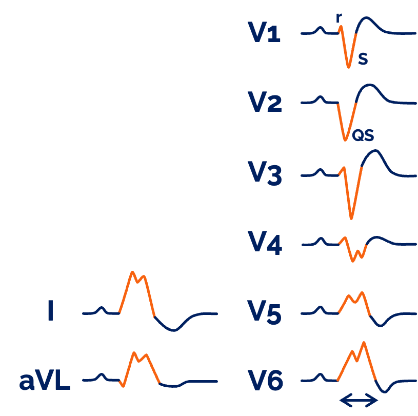 Kompletter Linksschenkelbock