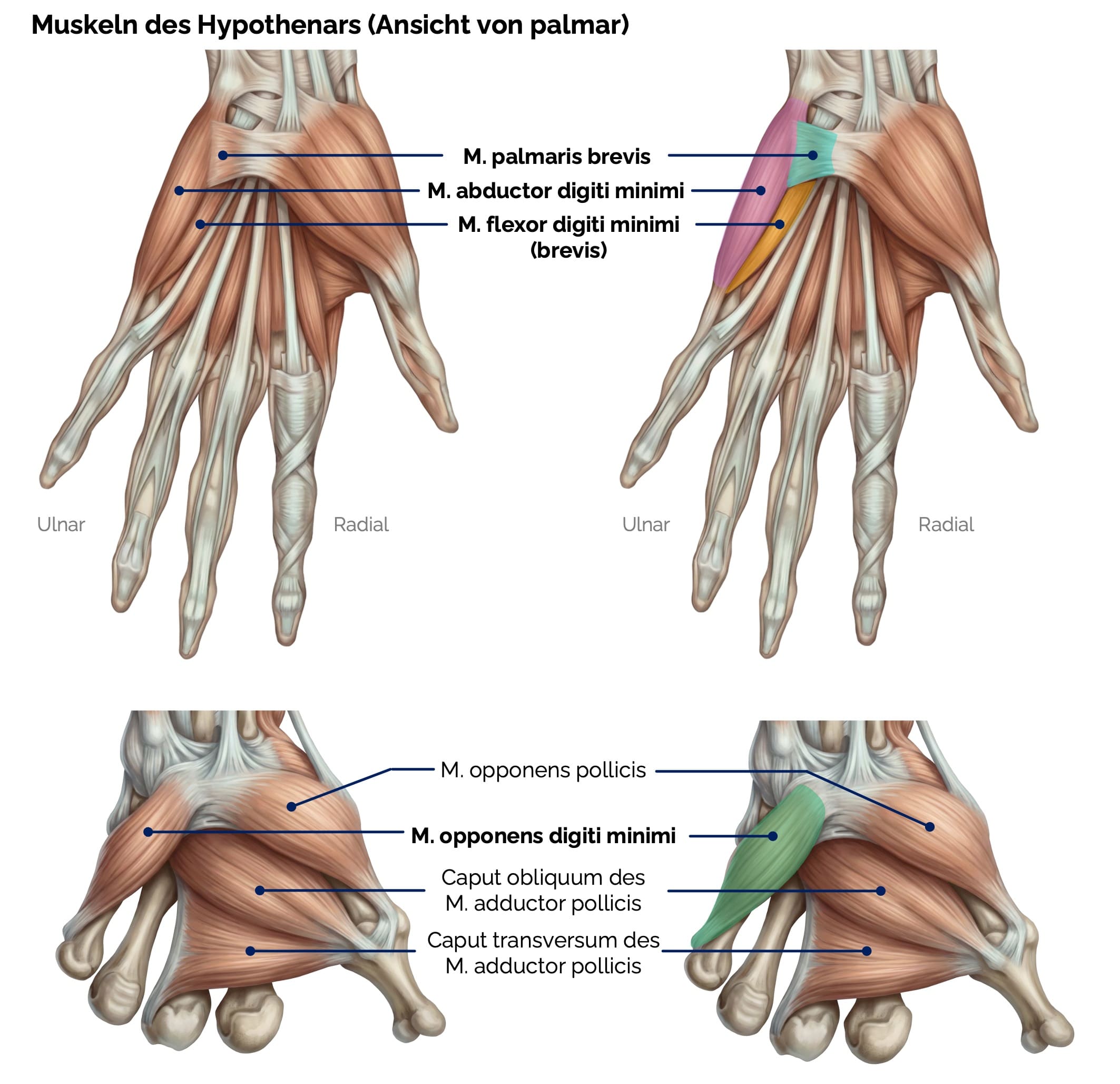 Muskeln des Hypothenars