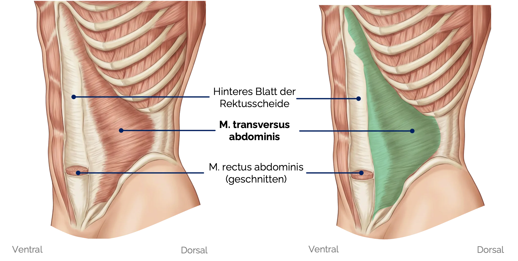 M. transversus abdominis