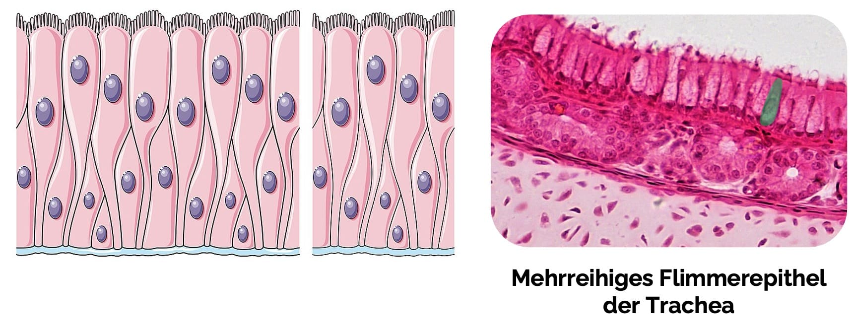 Mehrreihiges Epithel