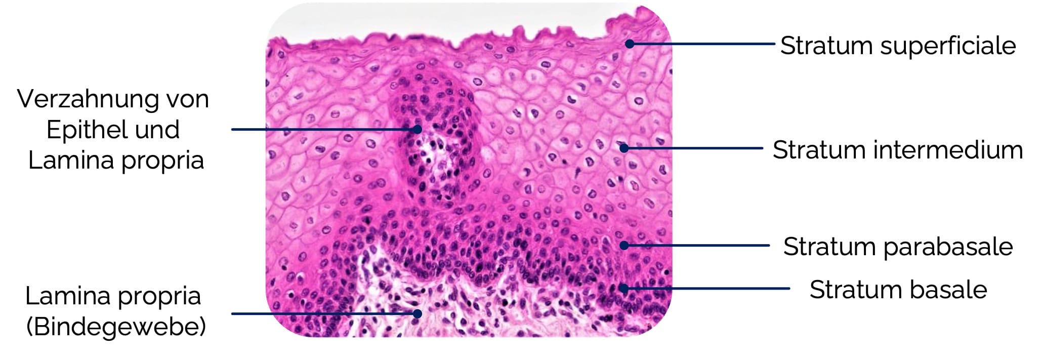 Mehrschichtiges unverhorntes Plattenepithel