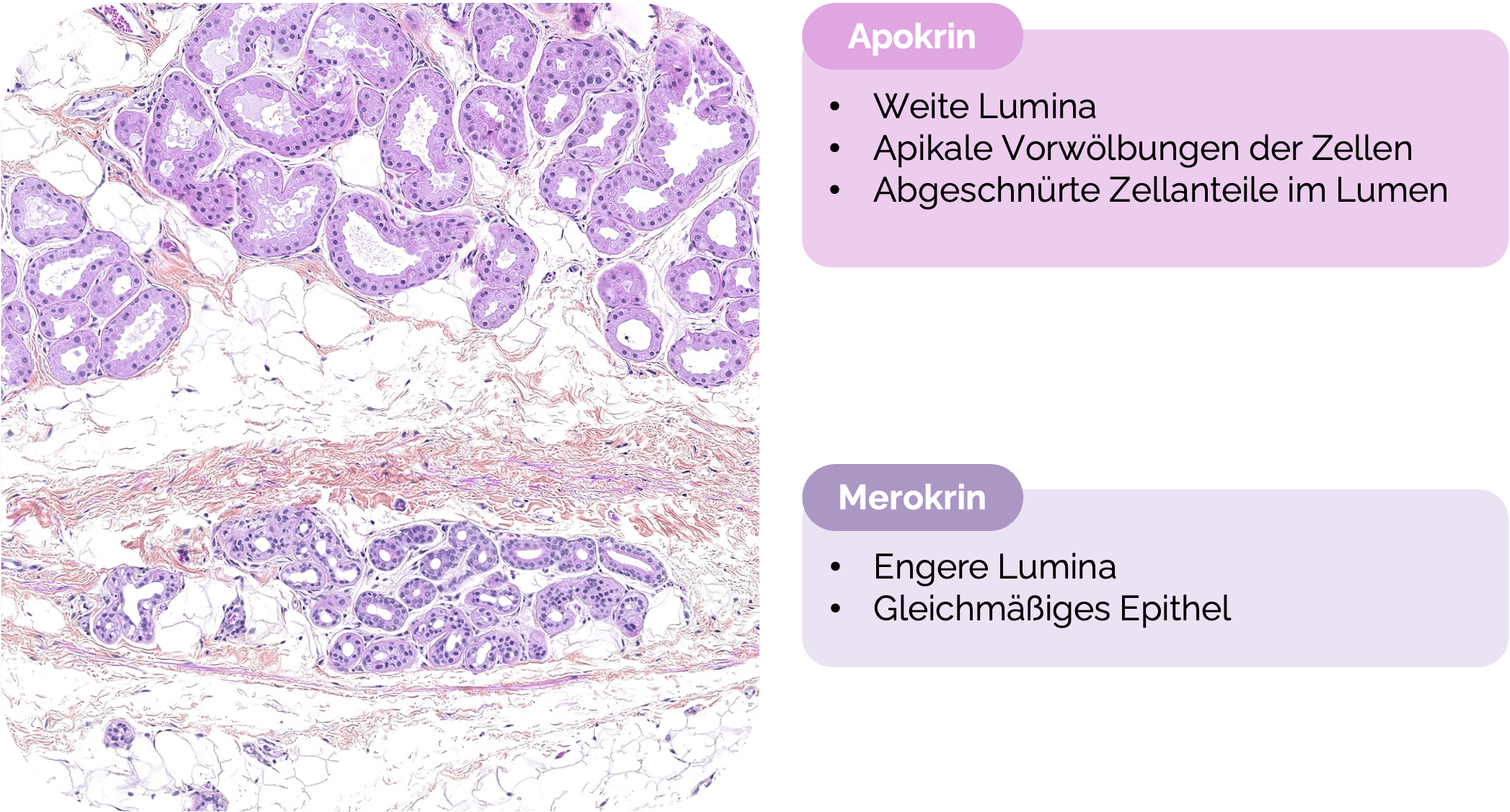 Merokrine Schweißdrüse (obere Bildhälfte) und Apokrine Schweißdrüse (untere Bildhälfte)
