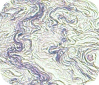 Milchdrüse – Elastische Fasern: