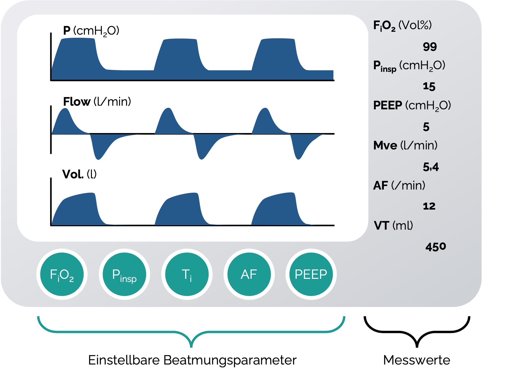 Beispielhafte Darstellung eines Monitors eines Beatmungsgeräts