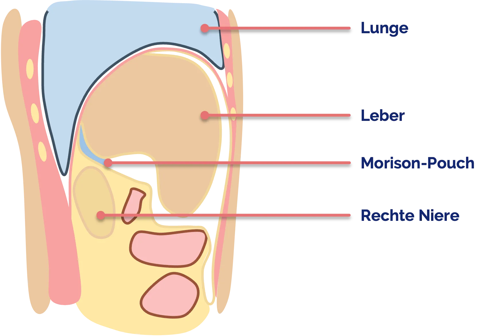 Morison-Pouch