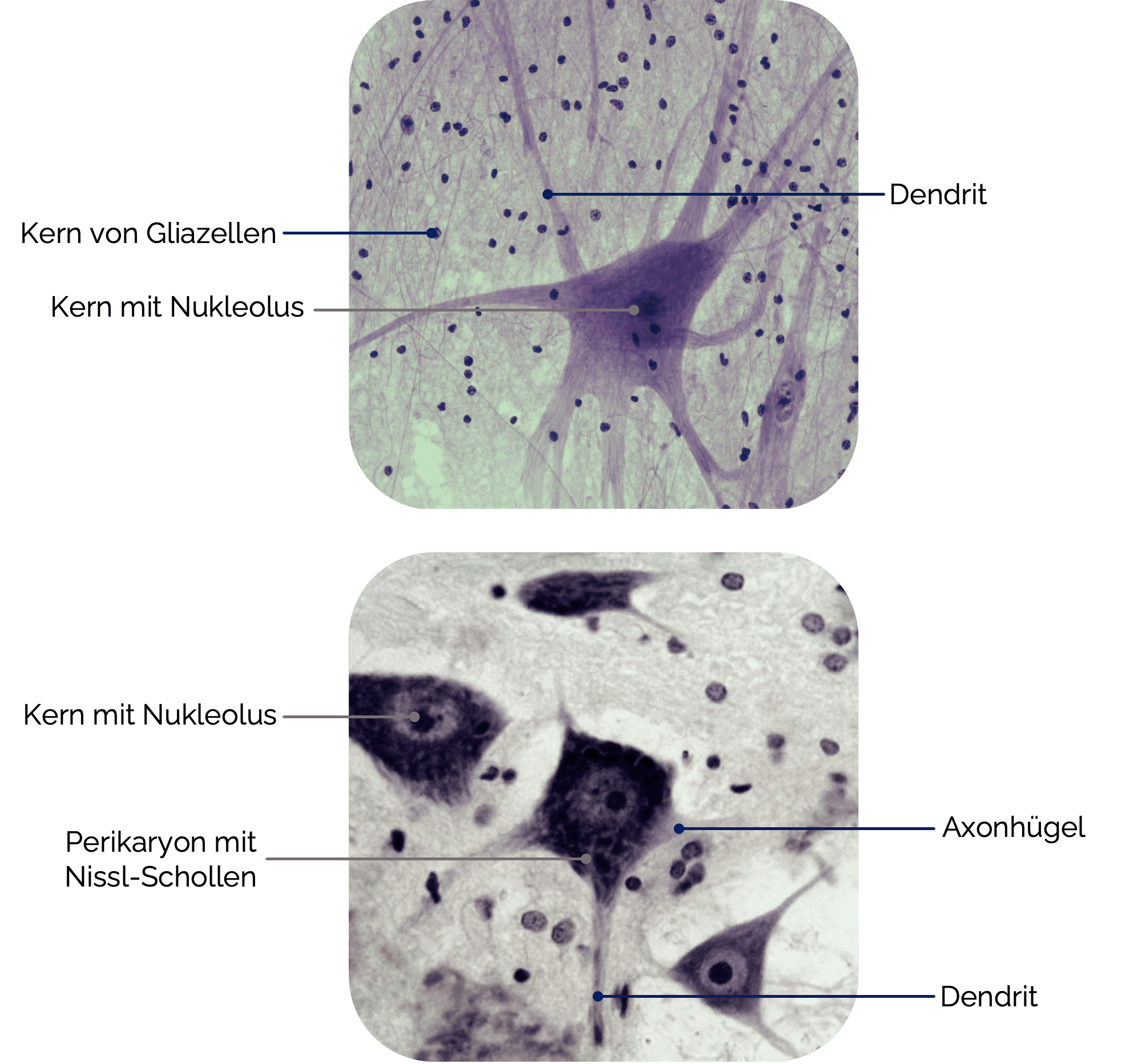 Motorneuron des Rückenmarks