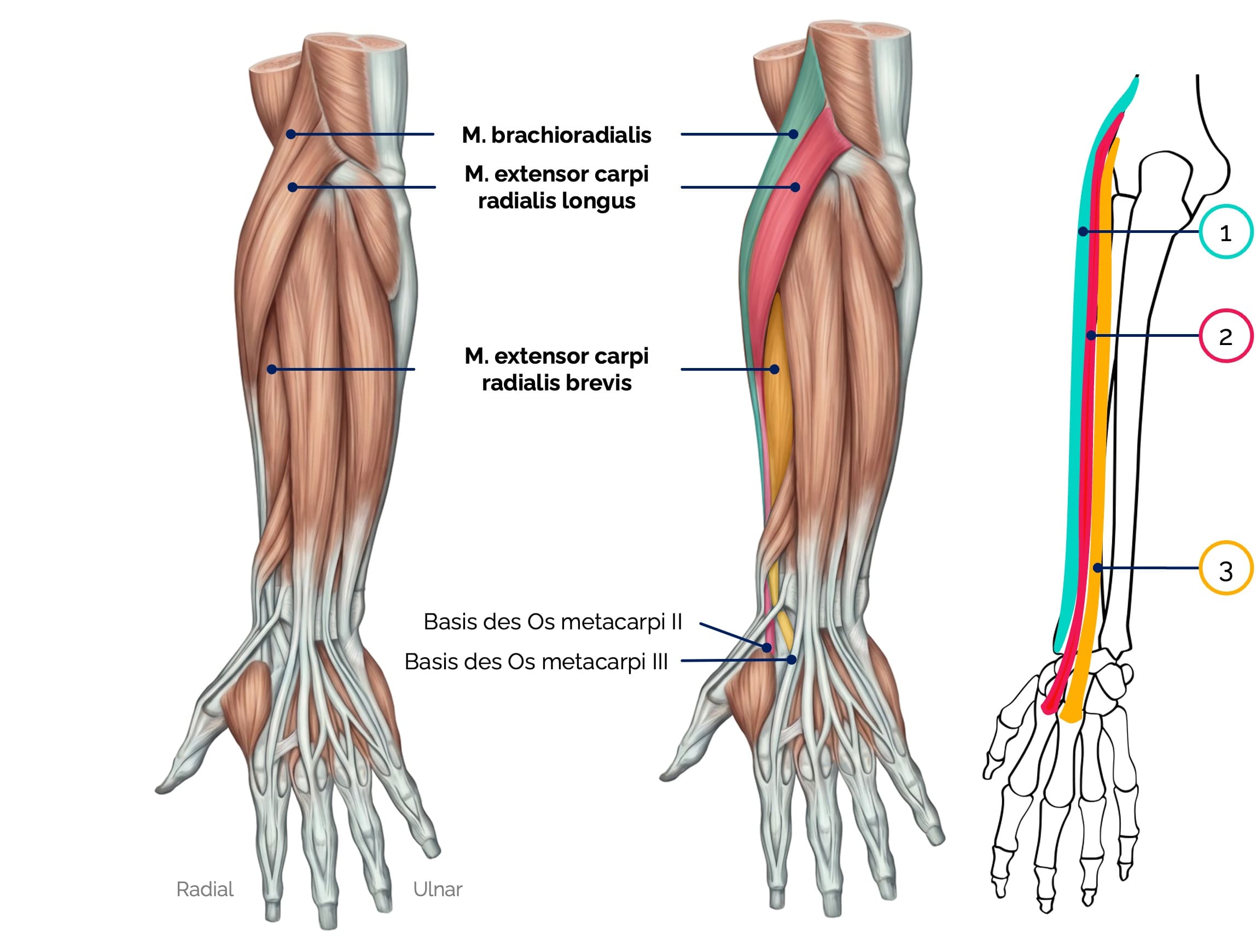 Radiale Unterarmgruppe