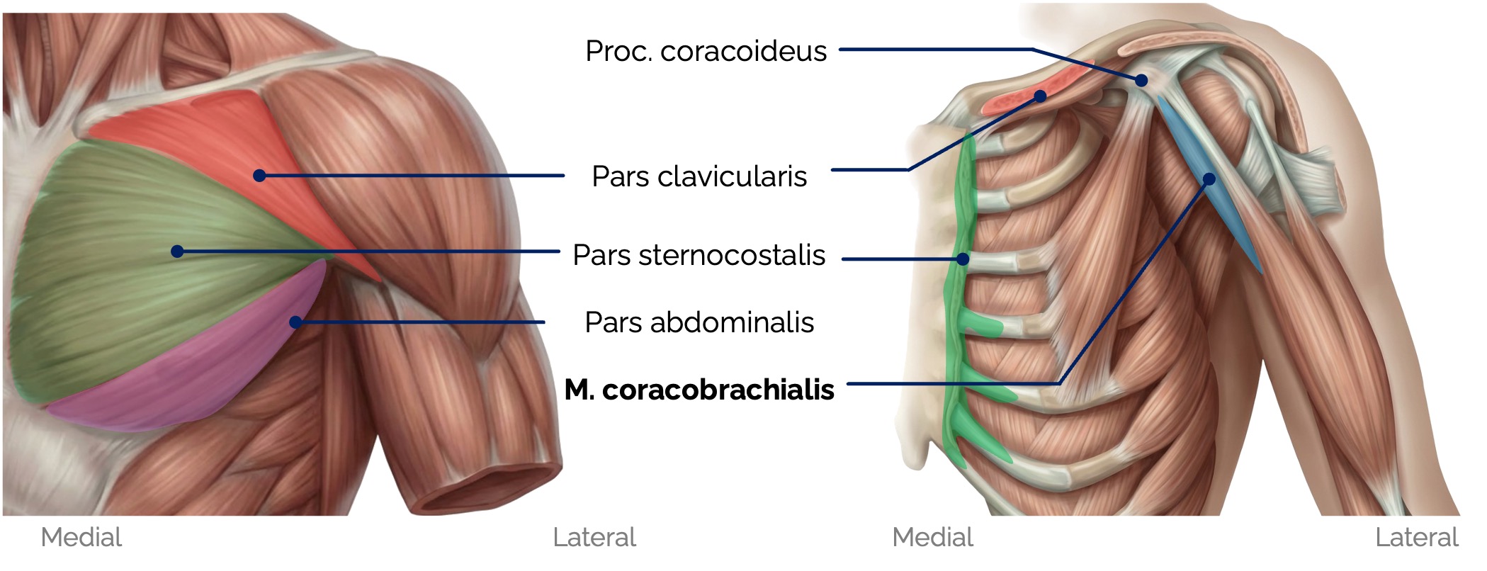 M. pectoralis major und M. coracobrachialis