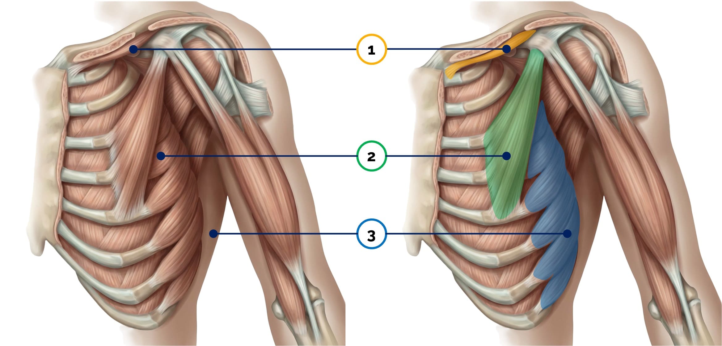 Ventrale Rumpf-Schultergürtel-Muskeln