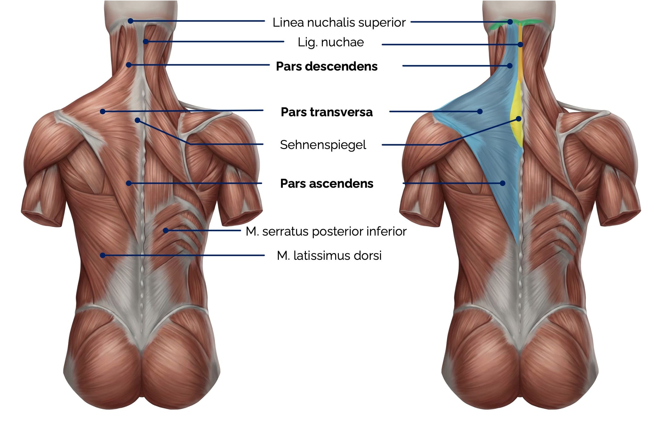 Musculus trapezius (Ansicht von dorsal)