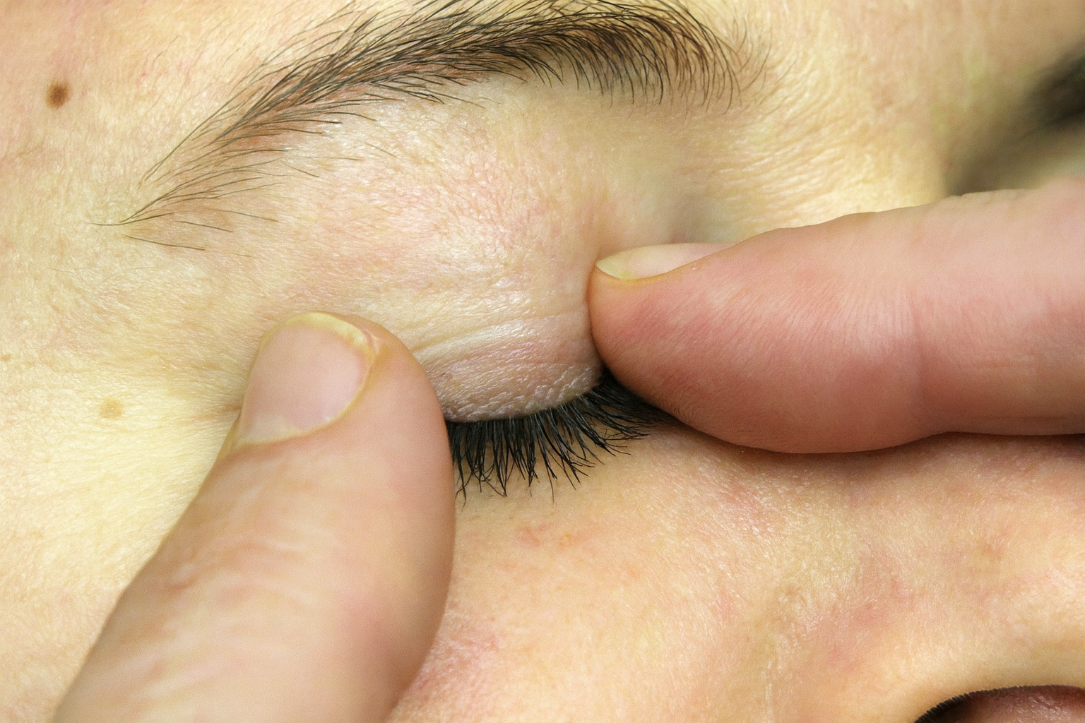 Palpation des Auges