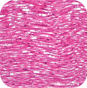 Peripherer Nerv im Längsschnitt mit typischen Wellenmuster