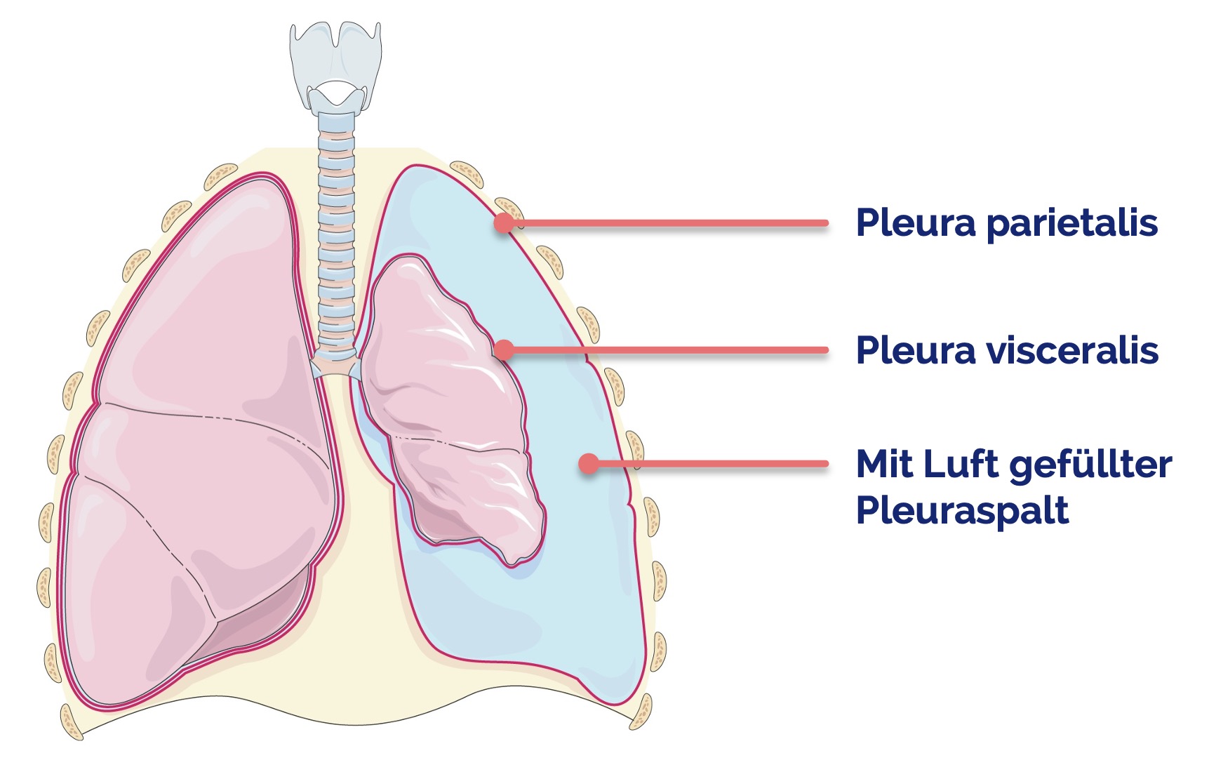 Pneumothorax