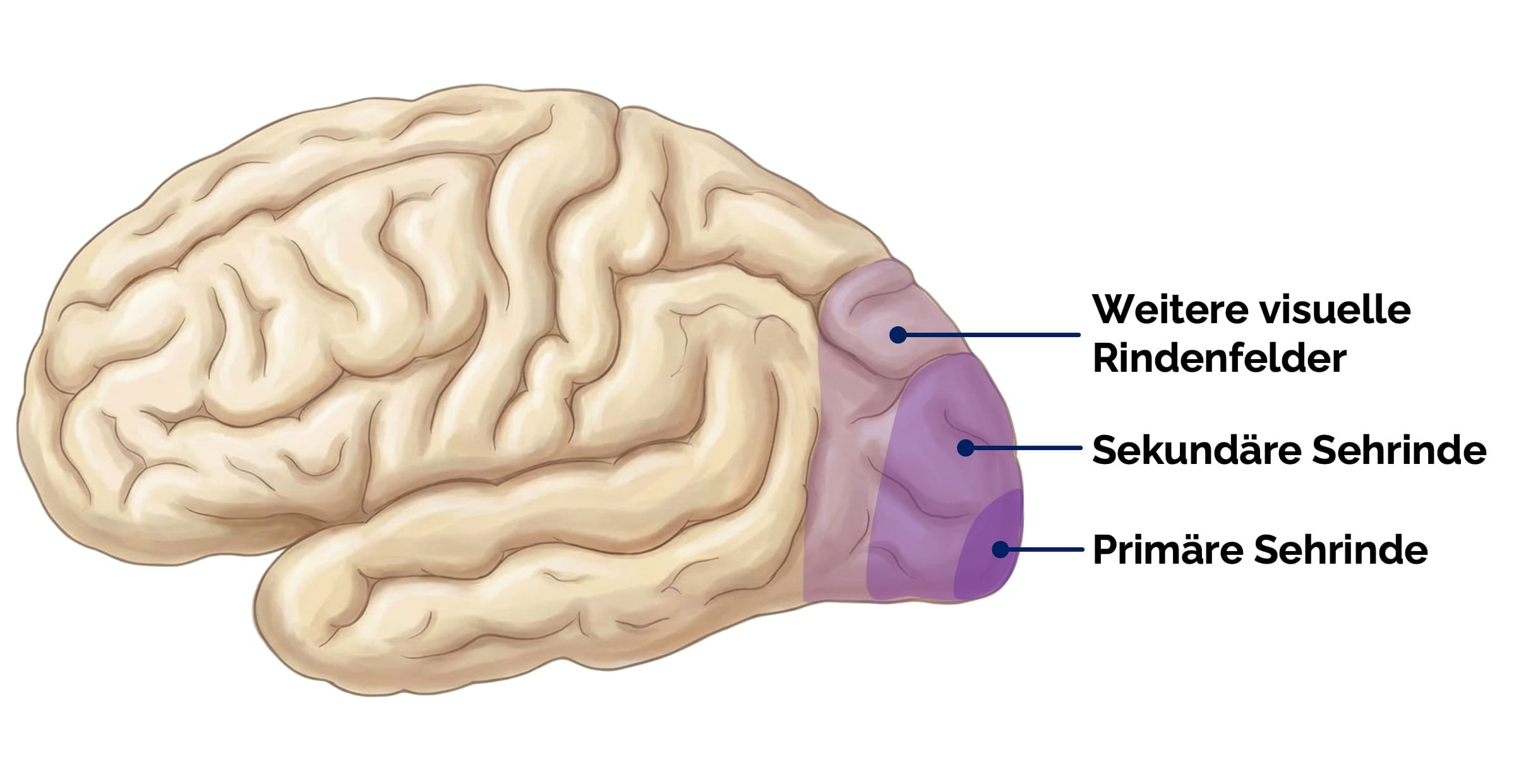 Sehrinde im Okzipitallappen