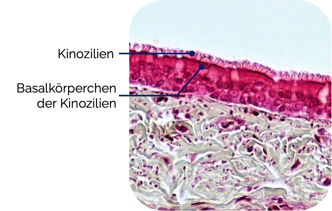 Respiratorisches Flimmerepithel