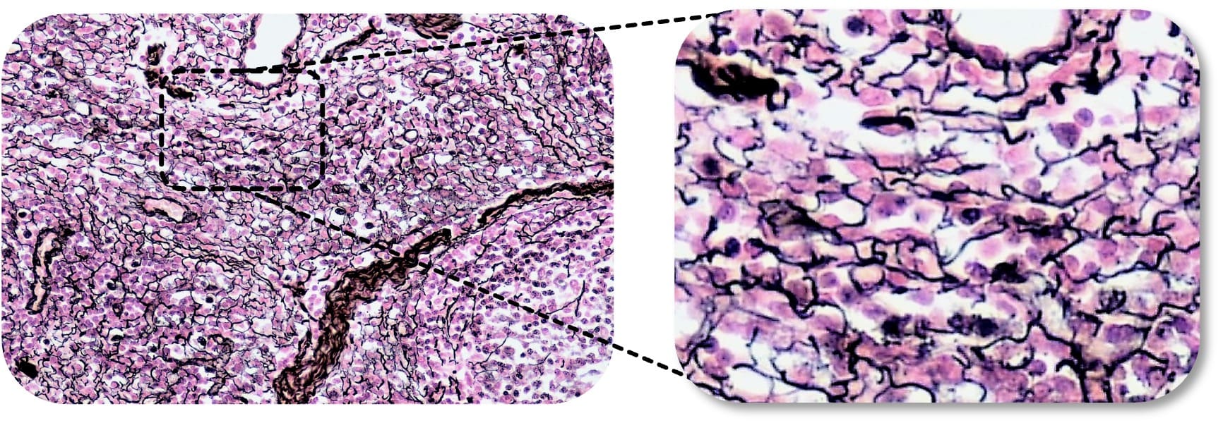 Retikuläres Bindegewebe (Silberimprägnation)