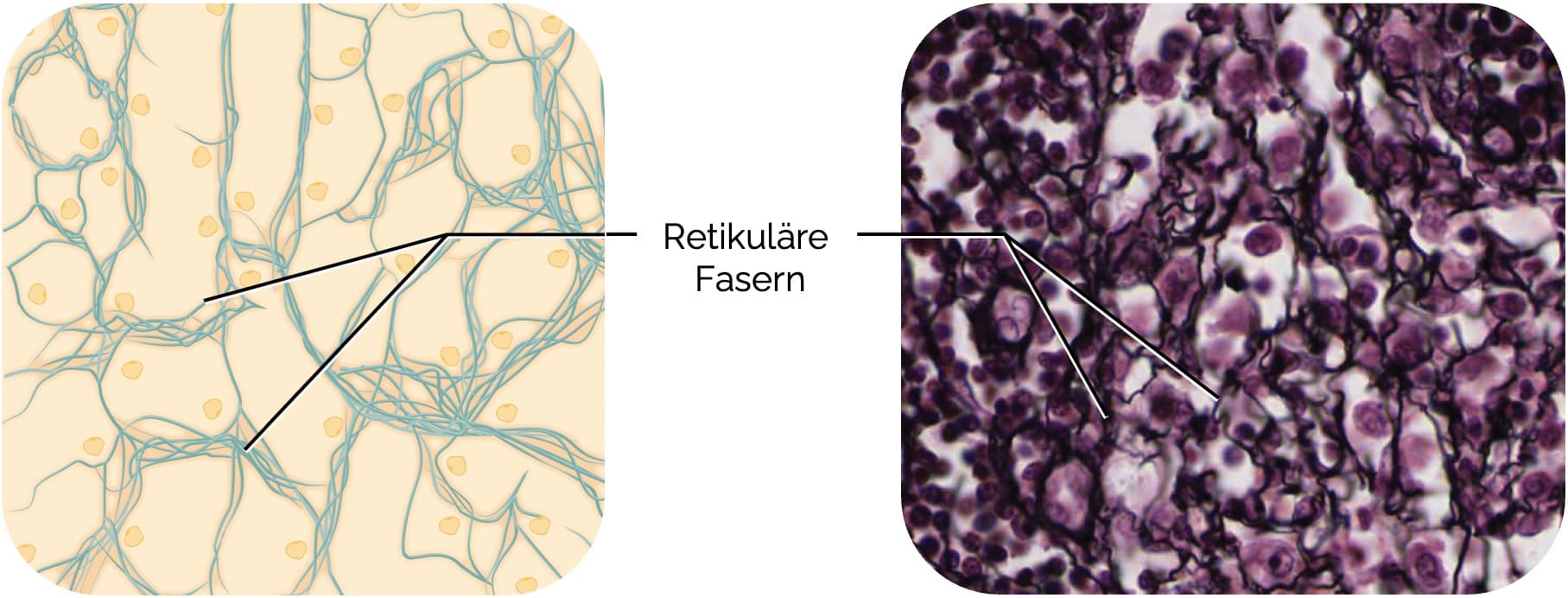Retikuläres Bindegewebe