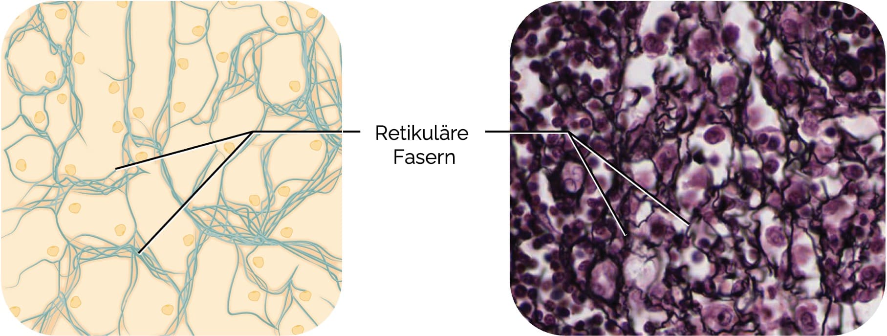 Retikuläres Bindegewebe