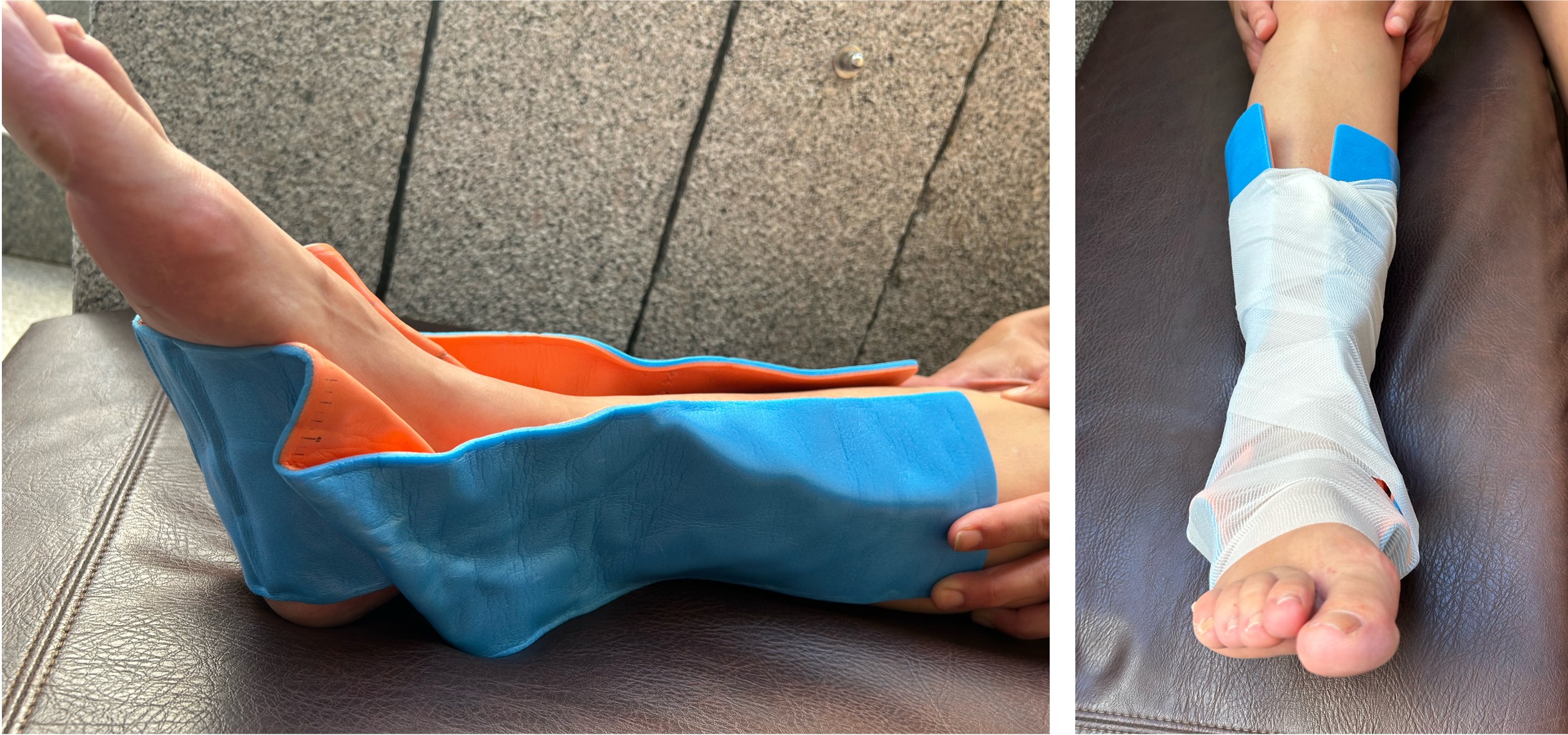 Aluminiumpolsterschiene Bein