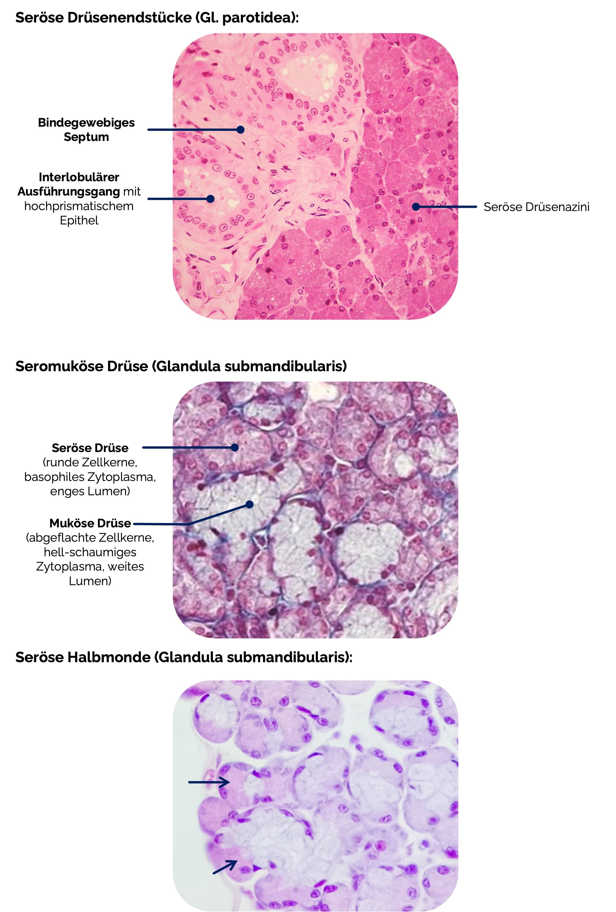 Seröse Drüsenendstücke, Seromuköse Drüse und Seröse Halbmonde