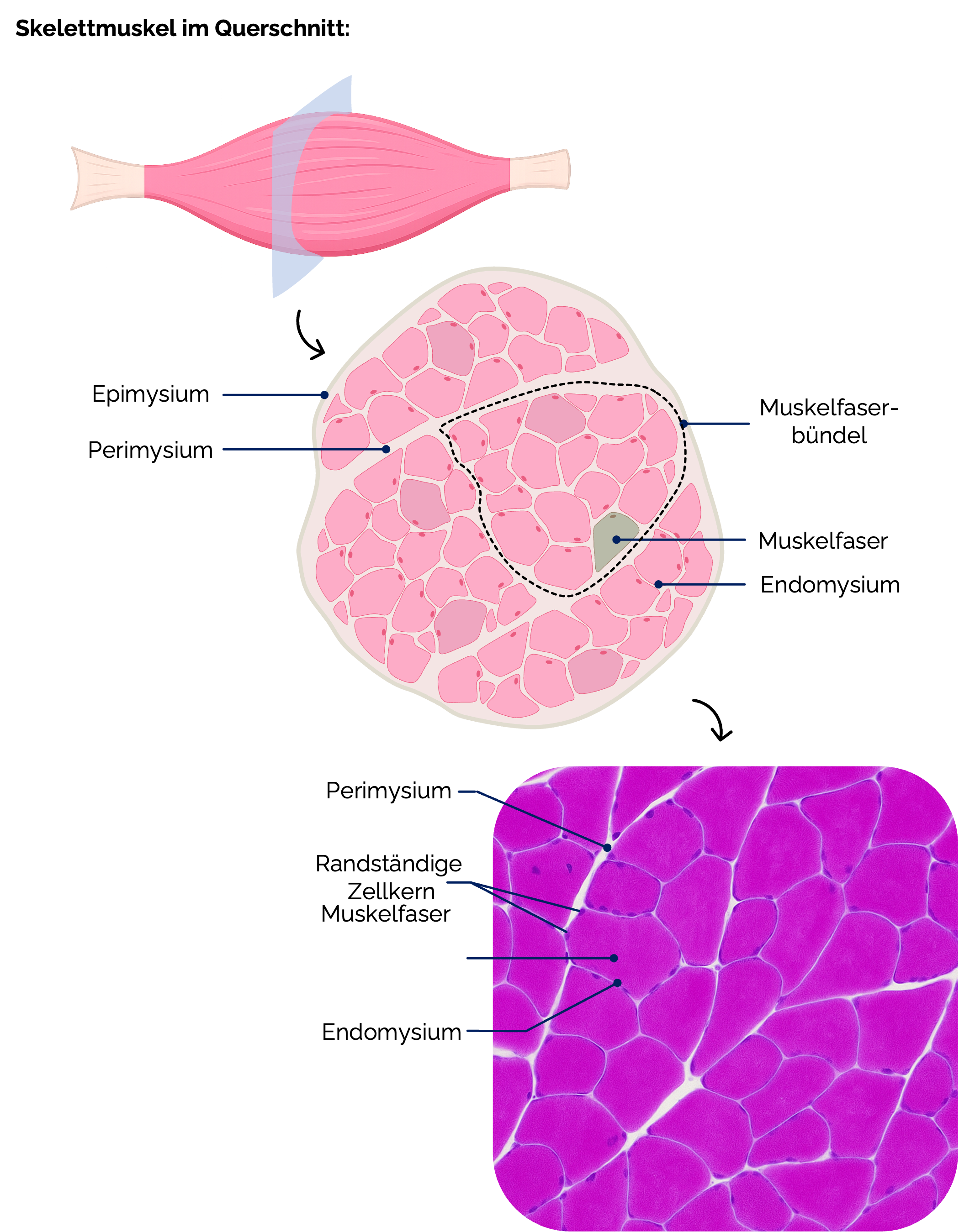 Skelettmuskel im Querschnitt:Skelettmuskel im Querschnitt