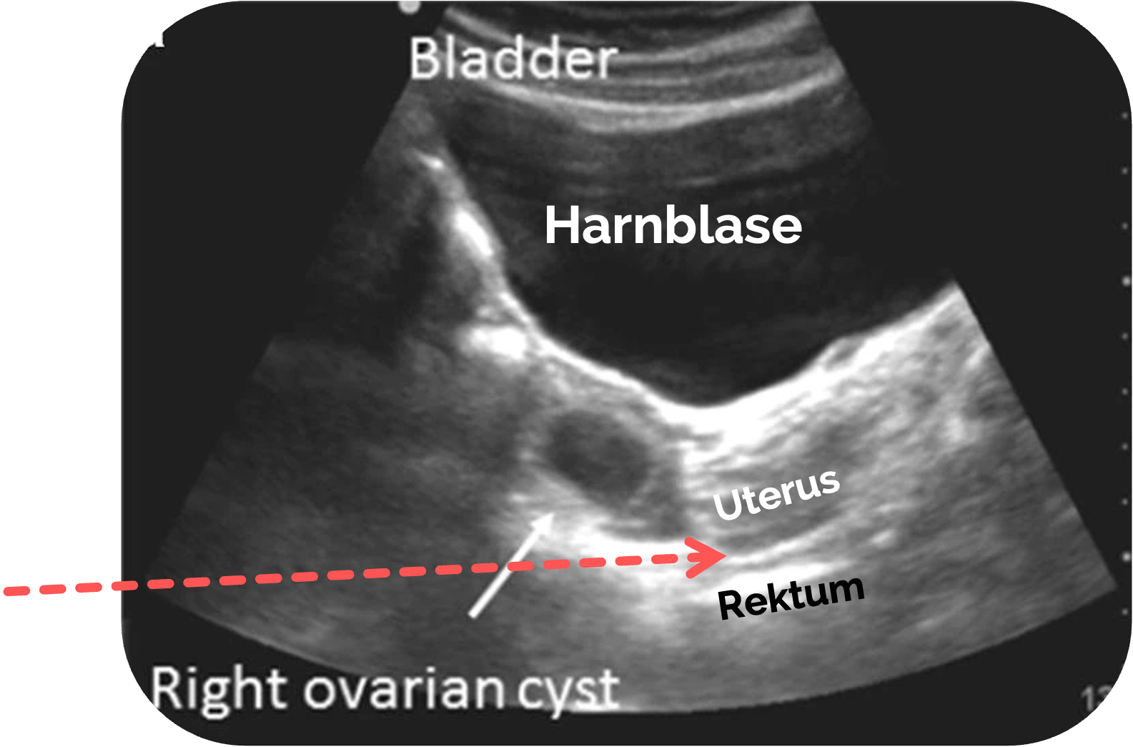 Normalbefund bei der Frau