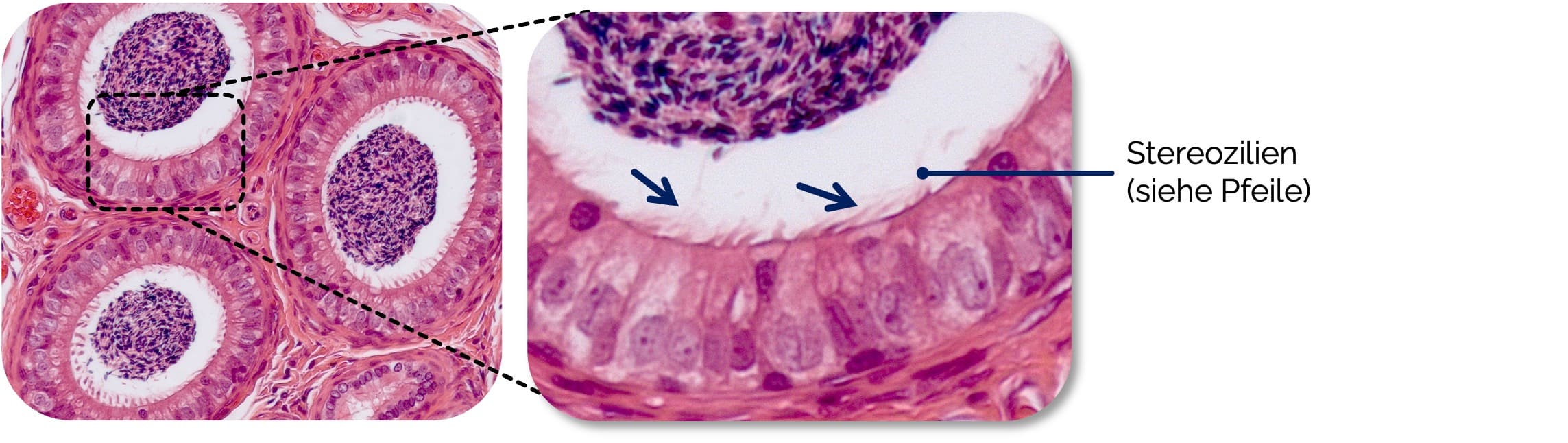 Stereozilien (Epithel des Nebenhodengangs)