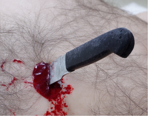 Penetrierende Stichverletzung